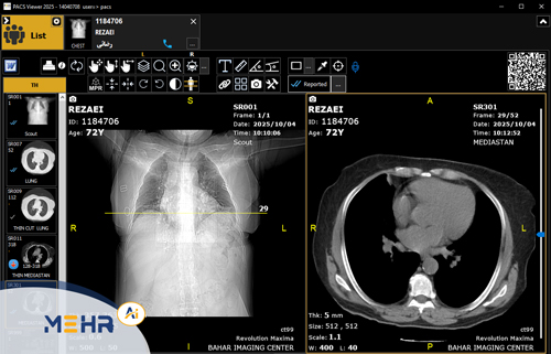 پکس سی تی اسکن (CtScan pacs)
