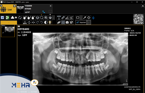 یکپارچه‌سازی HIS، RIS و PACS؛ ستون فقرات مراکز تصویربرداری